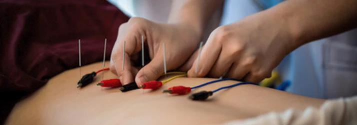 Practitioner attaching electroacupuncture leads to needles placed along the patient’s lower back.